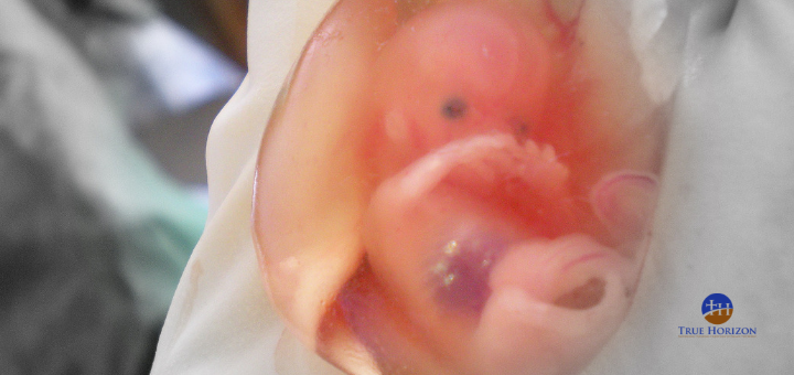 Fetus At 10 Weeks In The Womb